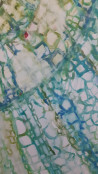 Kristina Čivilytė tapytas paveikslas Medžio kamienas pro mikroskopą, Abstrakti tapyba , paveikslai internetu